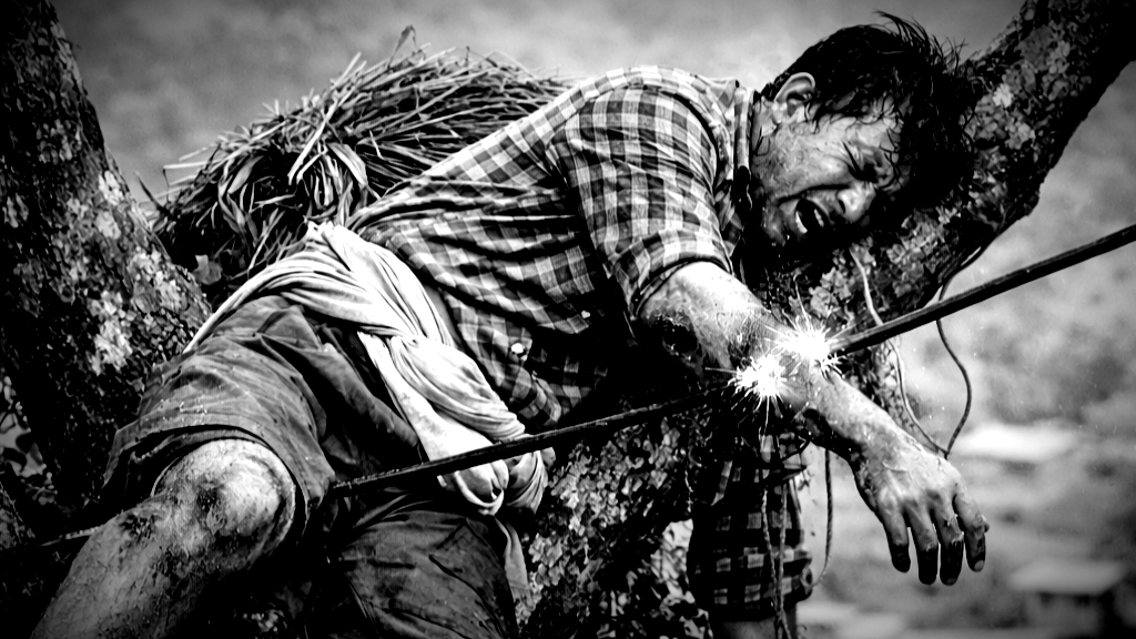 भीरकोटको करेन्ट दुर्घटना लुकाउँदै स्याङ्जा प्रहरी, शनिबार करेन्ट लाग्दा खनाल गम्भीर घाइते